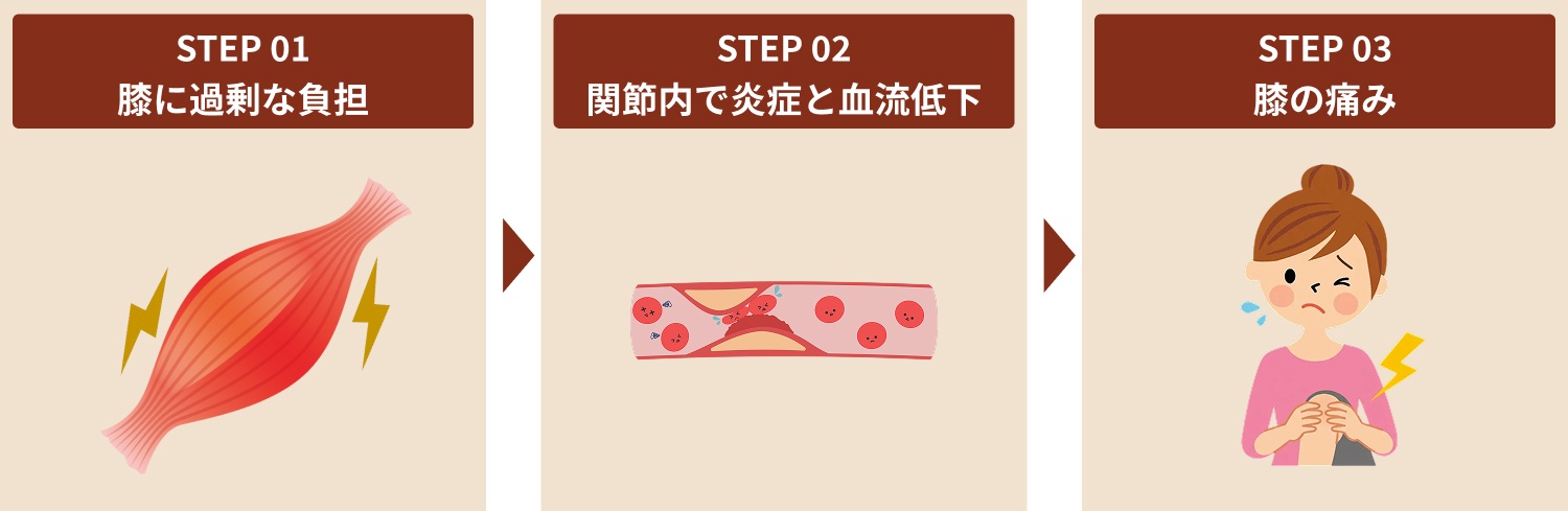 膝の痛みの原因・症状